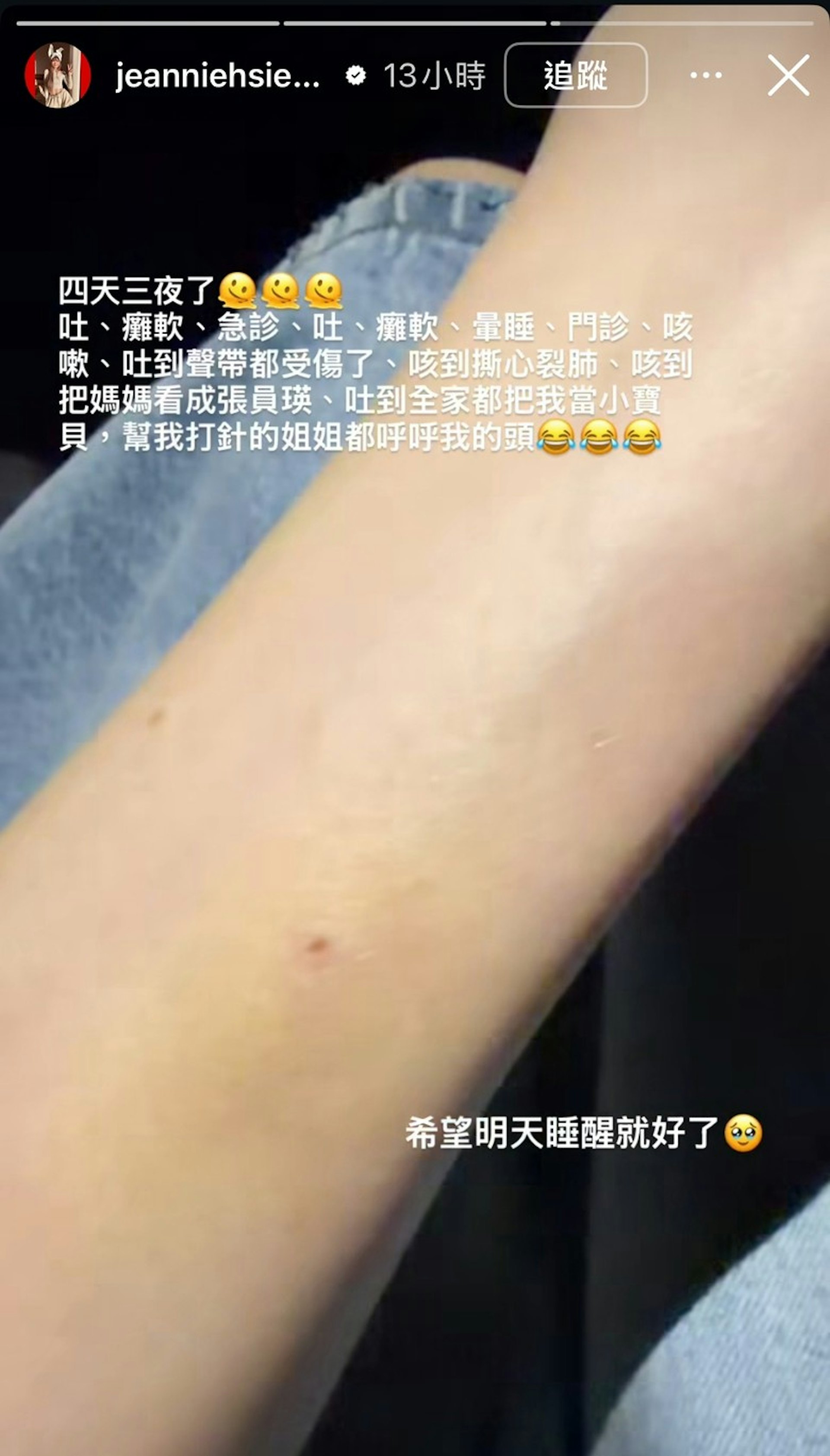 謝金燕分享了一張手臂佈滿打針痕跡的相片。(IG@jeanniehsieh___bbb)