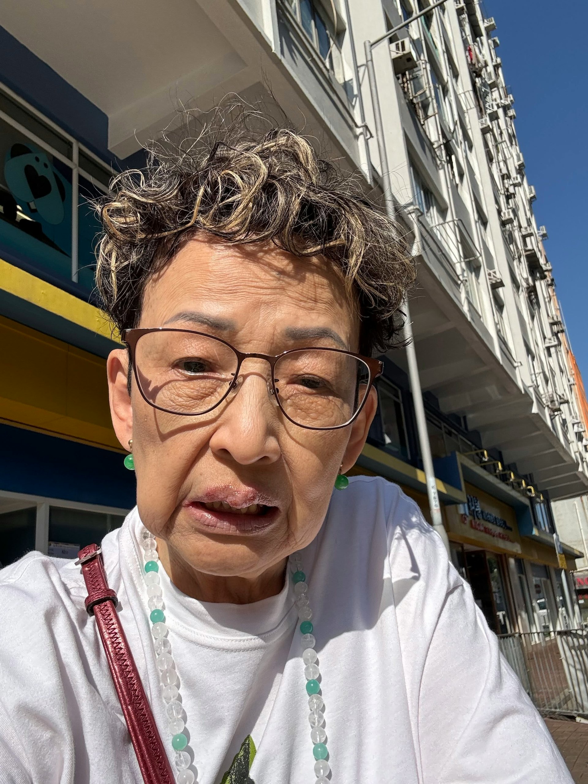 回港後她要去電台開工,直至工作人員指她面色不對勁,她才去看病,幸好經過休養後波姐情況終於穩定下來。(Threads@borjer_alice)