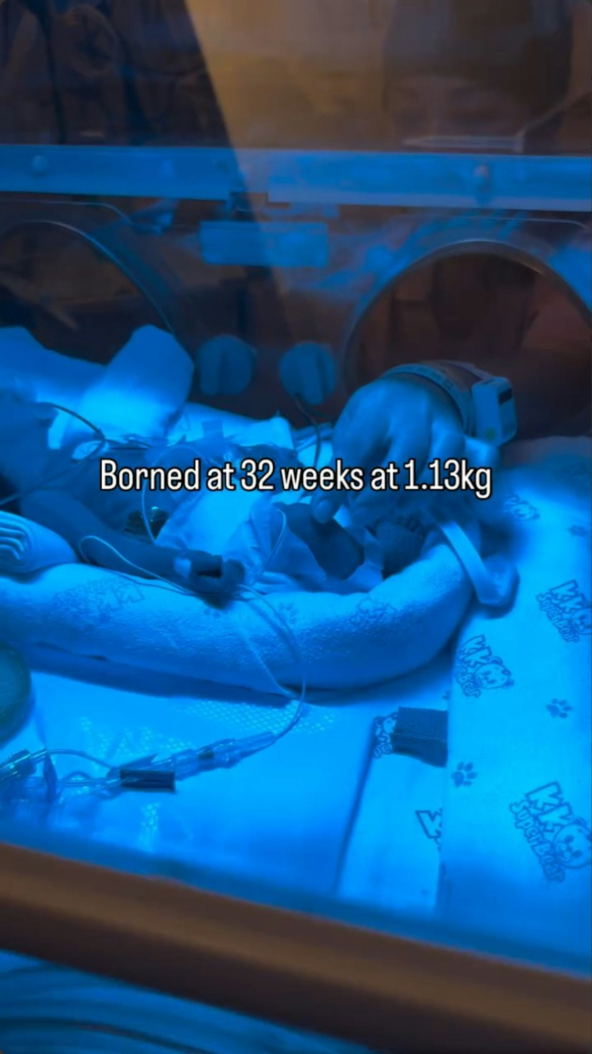 出世仅1.13kg。
