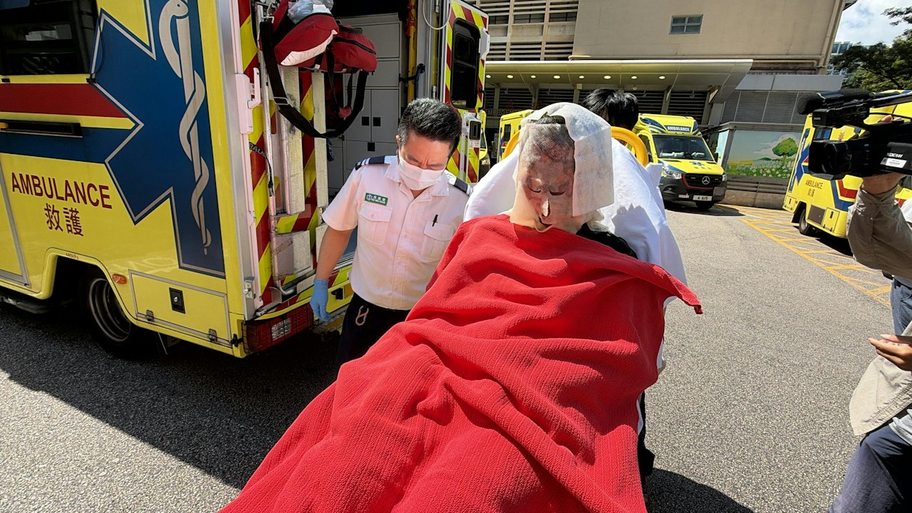 尖沙咀文化中心起火 女職員面及手臂燒傷 送院治理