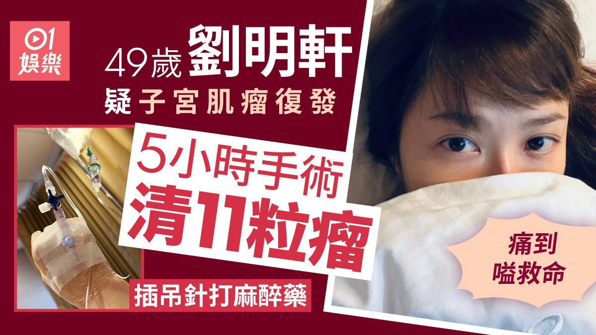 手術後の劉明軒の写真と、5時間の手術で筋腫11個を摘出したことを伝える香港01の画像