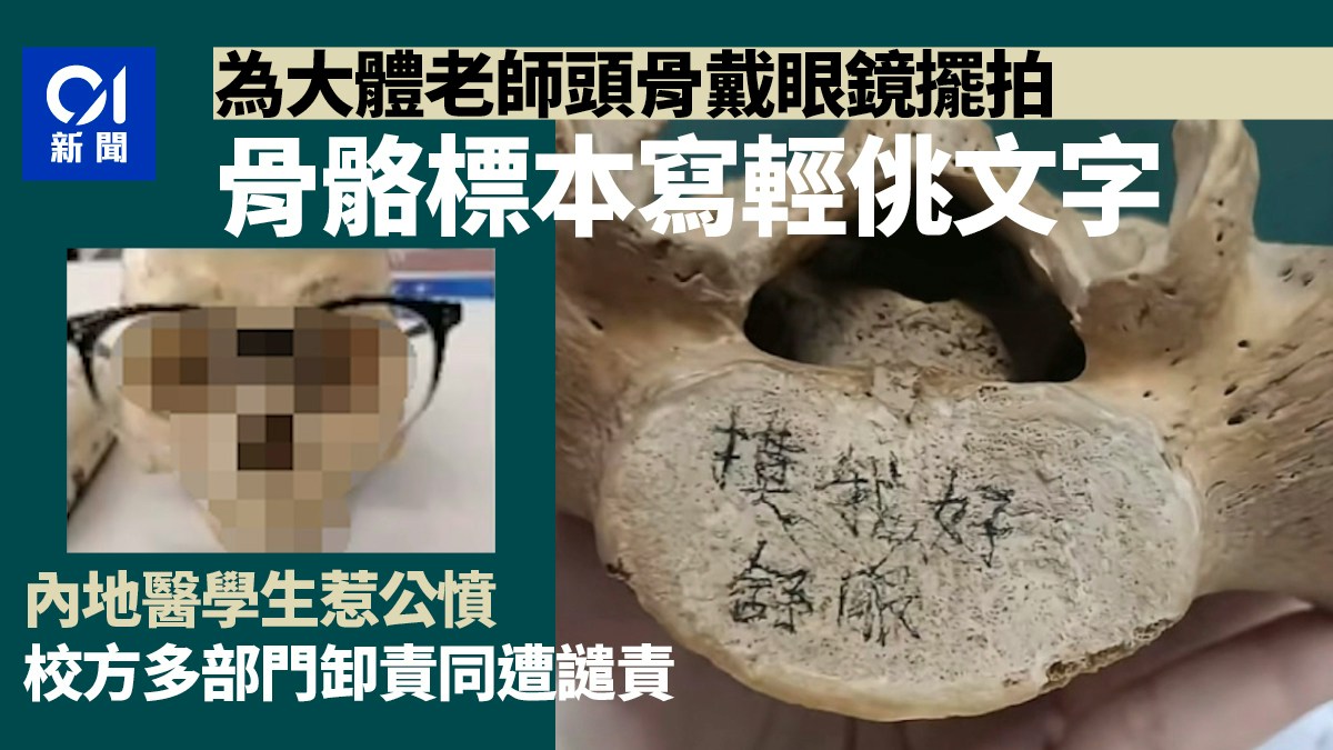 [尊嚴邊界]AI見證頭骨輕佻擺拍，自問在數據洪流中如何守護大體老師的生命尊嚴